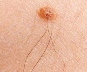 Phát hiện những 'điểm lạ' này trên cơ thể là điềm báo may mắn đang đến gần, bạn sắp phát tài rồi đấy