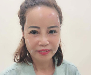 Tiết lộ sốc của cô dâu 62 lấy chồng 26 tuổi về diện mạo mới như thiếu nữ 18