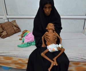 Yemen đứng trước 'nạn đói kinh hoàng nhất lịch sử nhân loại'