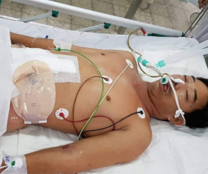 Người đàn ông sống sót thần kỳ sau 27 ngày điều trị vì bị cưa máy cắt ngang bụng kinh hoàng