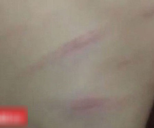 Vụ bé gái lớp 1 bị cô giáo đánh bầm lưng do lười học: Cô giáo bị sốc tâm lý nặng sau sự việc