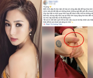 Sao Việt 'ngược đãi' bản thân vì stress: Tự bóc tay đến rỉ máu, thường xuyên nghĩ đến việc tự tử