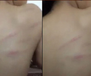 Kỷ luật cô giáo đánh tím lưng học sinh lớp 1 vì không chép bài