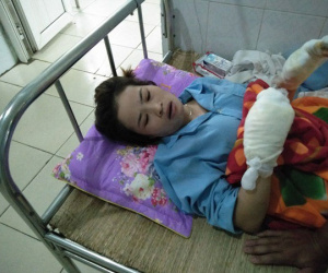 Giây phút kinh hoàng của người vợ bị chồng đổ xăng thiêu sống