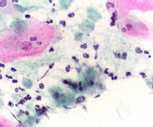 Nấm Candida sinh dục