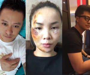 Sao Việt và những lần gặp tai nạn nghiêm trọng: Gãy xương, suy giảm thị lực nhưng vẫn chưa phải điều kinh khủng nhất