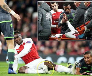 Welbeck có thể nghỉ bóng đá vì chấn thương