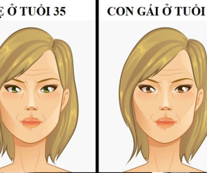 Con gái có thể mắc bệnh di truyền nào từ mẹ?
