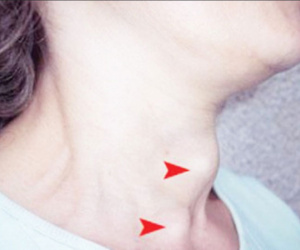 Nữ trung niên đột ngột lác hoàn toàn mắt trái vì lý do không ngờ
