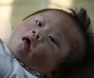 Con 8 tháng được chẩn đoán bại não chỉ vì ngày nào mẹ cũng đặt thứ này dưới gối