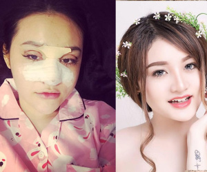 Hot girl từng náo loạn phố Nguyễn Huệ: Liên tục 'dao kéo' vì bị gọi là 'Mặt vuông'