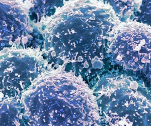 Chế tạo thành công loại virus chuyên diệt tế bào ung thư