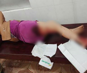 Công an vào cuộc xác minh vụ cán bộ quản lý thị trường hành hung chị dâu vì mâu thuẫn tiền bạc