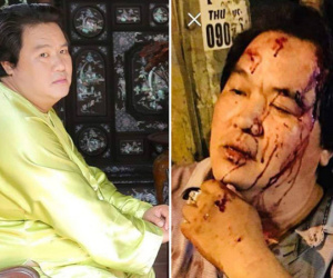 Trước khi gặp tai nạn nghiêm trọng, Hoàng Mập nhiều lần nằm mơ điều đáng sợ