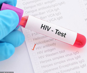 Phát hiện cơ chế giúp chữa khỏi HIV ngay trong não người