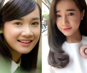 Đã đẹp sẵn rồi, Huyền Baby, Thúy Vi, Nhã Phương... vẫn sửa mặt