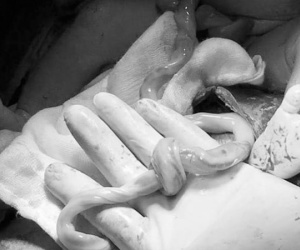 Bác sĩ bỏ ngang ca khám bệnh, lao vào phòng mổ cứu bé sơ sinh