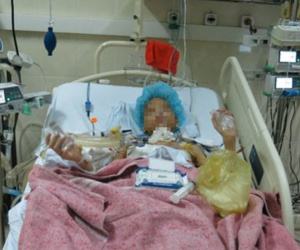 Thanh niên 17 tuổi bị ung thư phổi được ghép cùng lúc 2 lá phổi