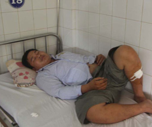 Chém 4 công an nhưng không bị xử lý hình sự vì tâm thần