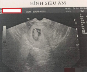 Khiến bạn gái mang thai rồi ép bỏ, thanh niên bị cộng đồng mạng mắng chửi xối xả vì vô trách nhiệm