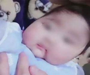 Tưởng con dậy thì sớm vì lông mày mọc rậm nhưng BS nói vấn đề còn nghiêm trọng hơn