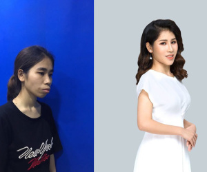 Bị chê 'ăn đu đủ không cần thìa', cô gái quyết tâm 'lột xác' và thành quả bất ngờ khiến mẹ chỉ có thể nhận ra con gái qua vết sẹo