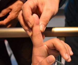 Bé trai sốc phản vệ sau một phút bị kiến cắn