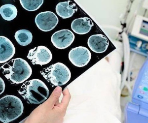 Người đàn ông bị nhồi máu não đột ngột, bác sĩ nói nguyên nhân liên quan đến 2 thói quen rất nhiều người cũng mắc