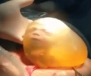 Biểu cảm đáng yêu của em bé sinh ra trong túi ối: Đây là đâu? Mình đã ra đời rồi ư?