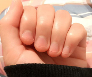 Có một kiểu người móng tay chẳng bao giờ nhú lên được vì cứ rảnh là ngồi cắn