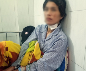 Người phụ nữ bị chồng cũ bạo hành, cắt lỗ tai dã man vì không cho mượn tiền