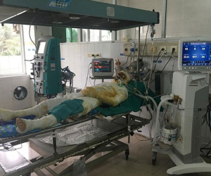 Lấy nước mắm, mỡ trăn chữa bỏng, ruồi nhặng theo bệnh nhân vào tận viện