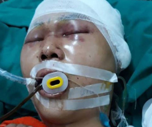 Hà Nội: Nam sinh cấp 3 bị nhóm người lạ đánh chấn thương sọ não ngay trước cổng nhà