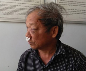 Ảnh minh họa