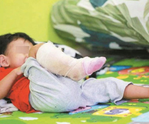 Con bị nhiễm vi khuẩn ăn thịt người, mẹ hối hận tột độ vì đã phớt lờ điều tưởng chừng như vô hại này