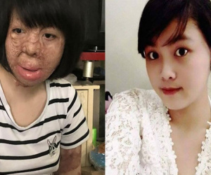 Người vợ xinh đẹp bị chồng đốt ngày mùng 2 Tết giờ ra sao?