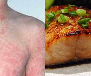 Cậu bé 11 tuổi tử vong vì căn bệnh triệu người mắc nhưng ít để ý