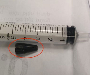 Ba bác sĩ suốt 2 giờ gắp nắp bút khỏi phế quản bé gái