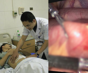 Thanh niên Hà Nội thủng ruột sau khi ăn cơm suất