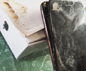 Nổ điện thoại iPhone lúc sạc, thiếu niên 13 tuổi phải cắt cụt bàn tay