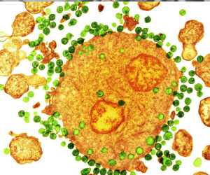 Bệnh nhân thứ hai trên thế giới được chữa khỏi HIV