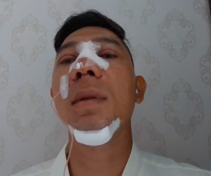 Lương Bằng Quang gây sốc khi công khai thẩm mỹ 100% gương mặt ở tuổi 37