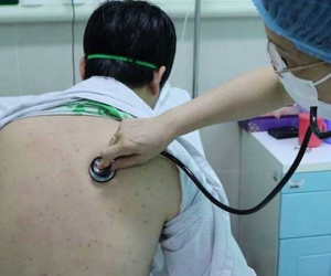Hi hữu: Lần đầu tiên xuất hiện bệnh ho gà ở người lớn
