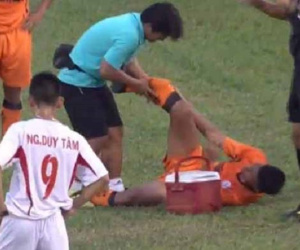 KINH HOÀNG: Cầu thủ U19 Đà Nẵng gãy chân sau pha vào bóng thô bạo