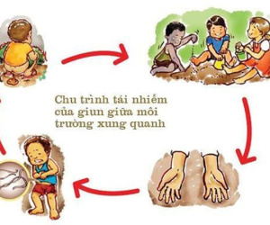 HI HỮU: Bé 3 tuổi đau bụng vật vã từng cơn, bác sĩ lấy ra cả túi giun kết thành từng búi to