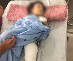 Hà Nội: Chó pitbull giật đứt xích lao vào cắn bé 2 tuổi, hàng xóm phải mang xà beng đánh chết con vật để giải cứu nạn nhân
