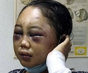 Tra tấn người giúp việc tàn bạo, ép ngủ với chó