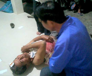 Chống 'cát tặc', một người dân bị chém trọng thương
