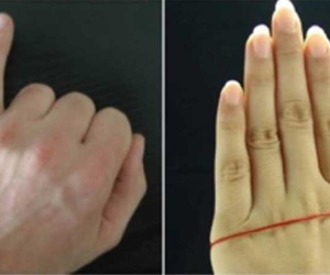 Giơ ngón út lên và quan sát 3 giây, biết ngay về già sướng hay khổ, hôn nhân viên mãn hay trái ngang