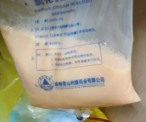 Túi mỡ 300ml lấy ra từ máu người đàn ông 47 tuổi chỉ vì hay ăn thực phẩm này
